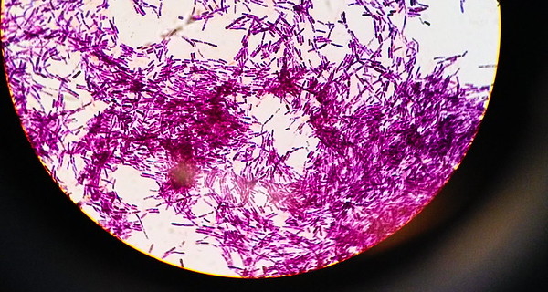 Biopesticides: A Safer Approach to Pest Control